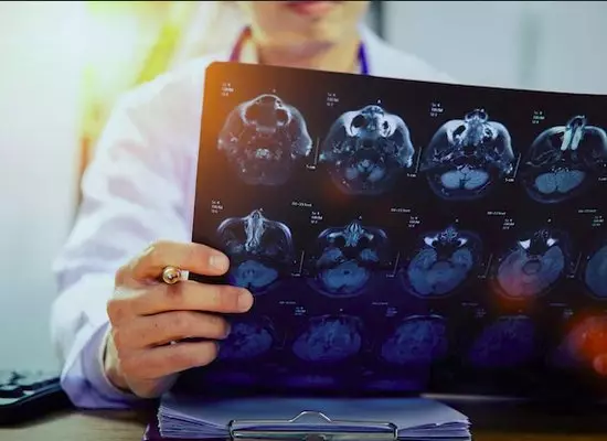 Neurologista