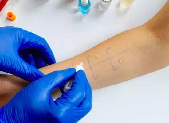 Alergologista e Imunologista
