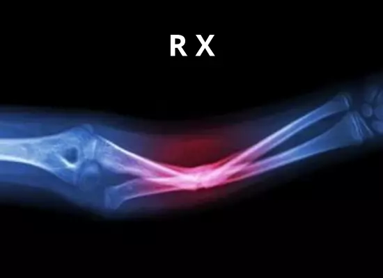 Raio-X do Torax
