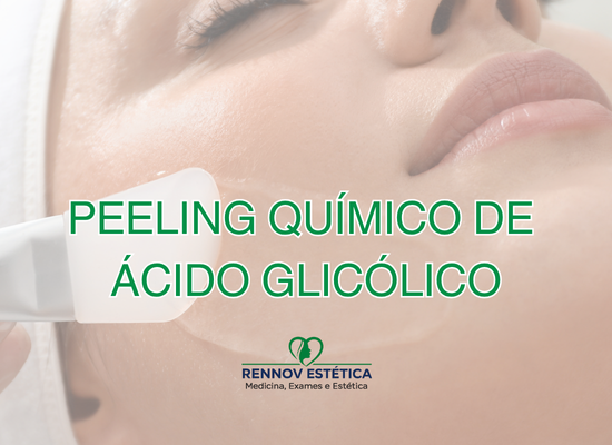 Peeling Químico
