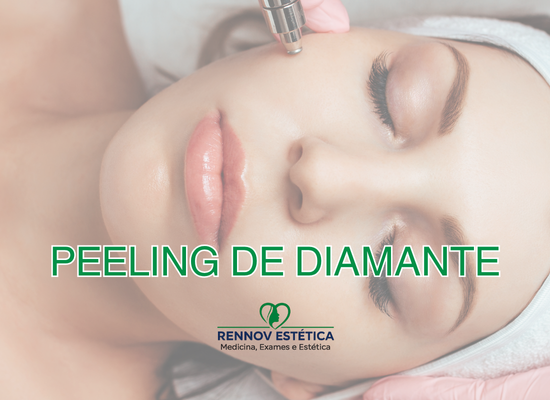 Peeling de Diamante
