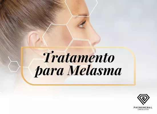 Tratamento para Melasma